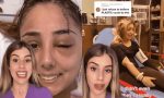 El accidente viral de esta chica: todo pasó por llevar en el coche un objeto que parecía inofensivo